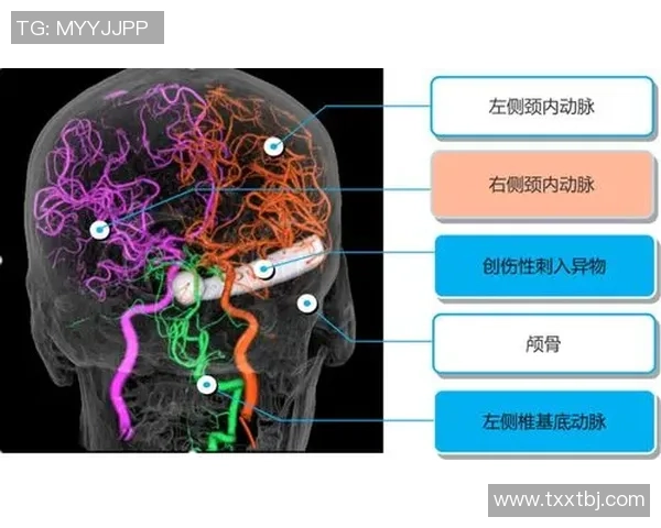 西安排球队盯防战术全解析:排球深度研究与实战应用 西安排球队盯防战术全解析:排球深度研究与实战应用